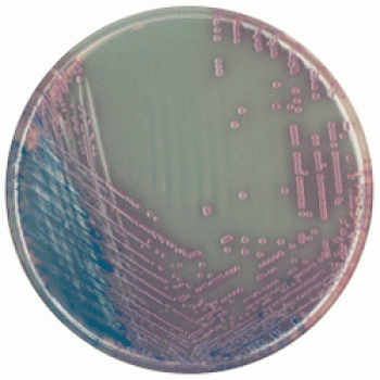 Cреда для выделения Salmonella | CHROMagar™ Salmonella 5000 мл CHROMagar