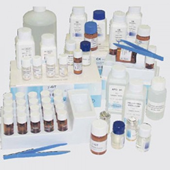 Билирубин общий, 9x40/1x12 мл (1200 опр.) Spinreact